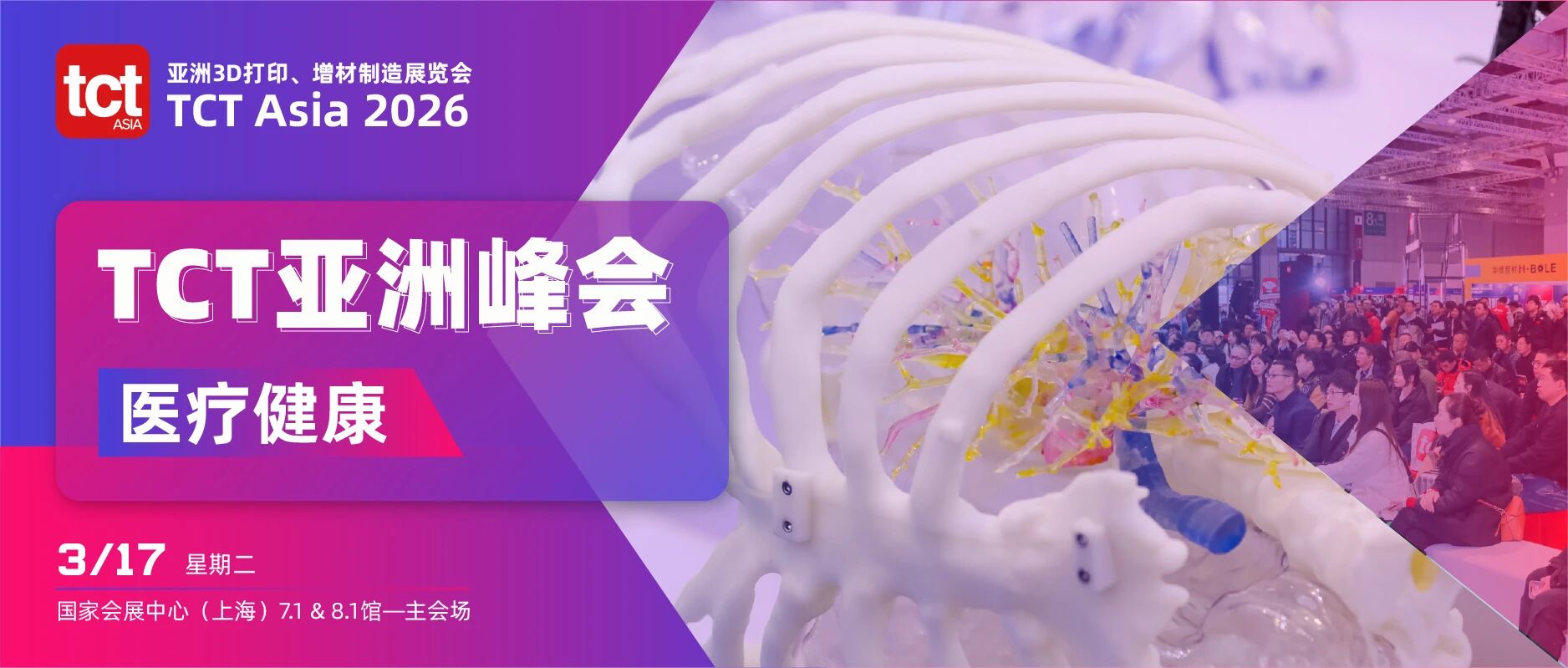 TCT峰会看个性化医疗新视角!九院专家解读3D打印植入物临床新成果